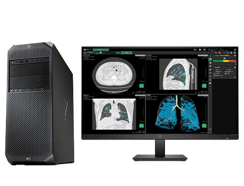 医学影像后处理分析 惠普HP Z6 G4 工作站 （英特尔至强铜牌 3204，6核丨32GB DDR4 内存丨512GB 固态+2TB SATA 机械硬盘丨AMD Pro WX 3200，4GB显卡丨惠普27英寸显示器）