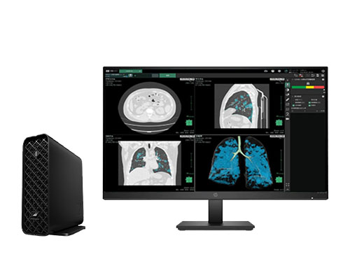 惠普 HP Z2 Mini G9 医用阅片电脑工作站（英特尔酷睿 i5-14500，14核丨32GB DDR5 内存丨1TB NVMe 固态硬盘丨NVIDIA T400，4GB 显卡丨27寸显示器）