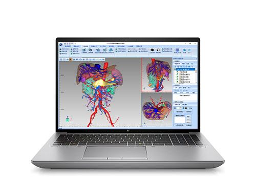 HP ZBook Fury 16 G11 移动工作站（英特尔酷睿 i7-14700HX，20核丨32GB DDR5 内存丨2TB NVMe 固态硬盘丨RTX 1000 Ada 6GB 显卡丨16英寸 WUXGA显示屏）