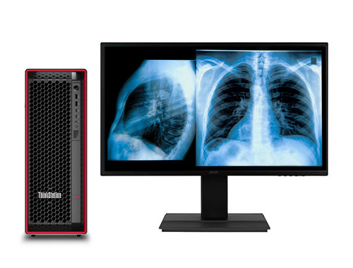 联想ThinkStation P5 医用阅片电脑工作站（英特尔至强 W3-2425，3.0GHz，6核丨32GB DDR5 内存丨1TB M.2 固态 +4TB 机械硬盘丨RTX 3050，8GB 显卡丨27寸显示器）